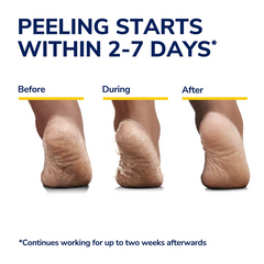 Dr.Scholl Rough Dry Skin Ultra-Exfoliating Foot Mask